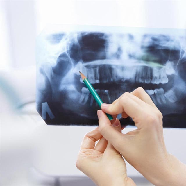 Radiografías digitales en HD y también para niños
