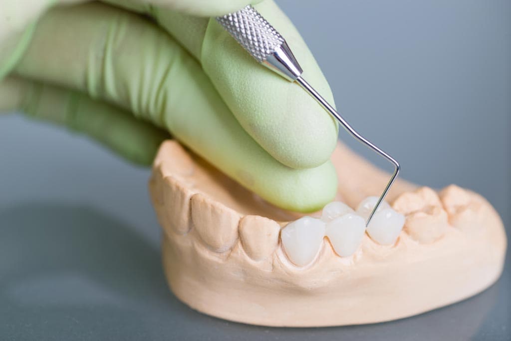 Expertos en prótesis dentales en Narón