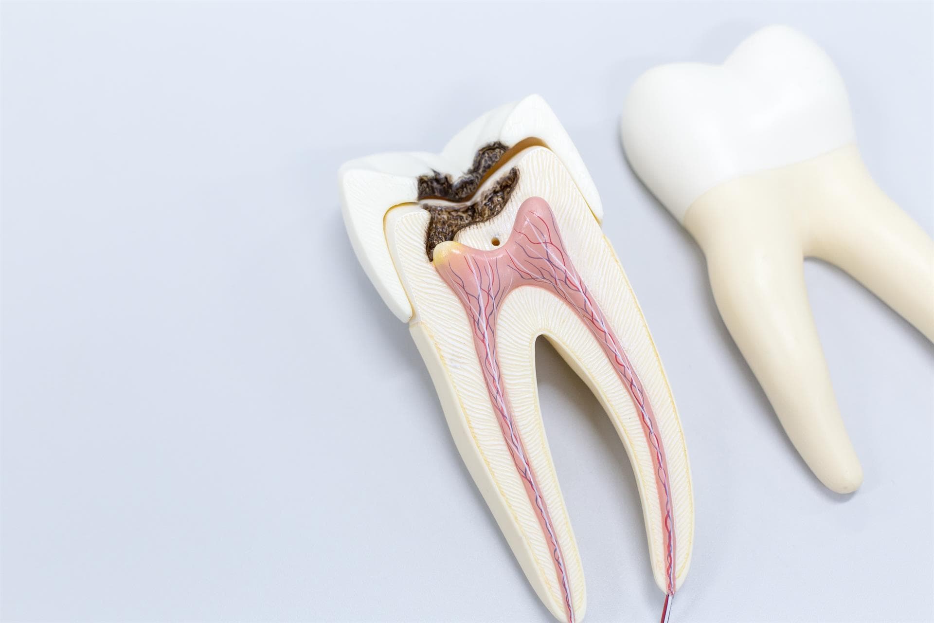 Endodoncia, un tratamiento rápido y preciso
