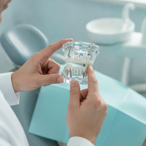 Rehabilitación oral completa con implantes en Ferrol - Imagen 1