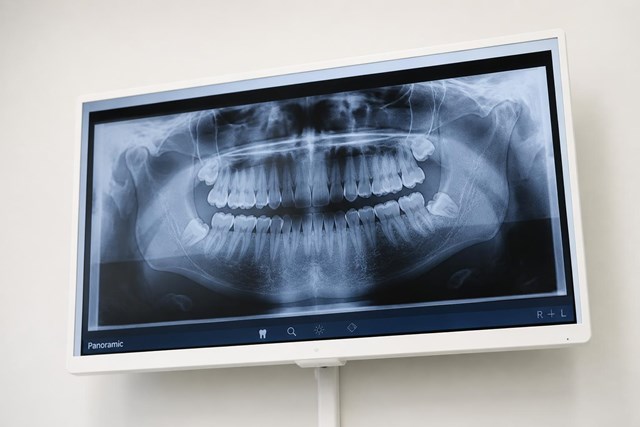 TAC dental y radiografías digitales pediátricas en Ferrol - Imagen 1